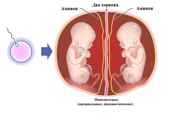 Возможная двойня после процедуры ЭКО