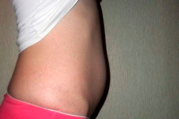 Размер живота у беременной на сроке 7 недель