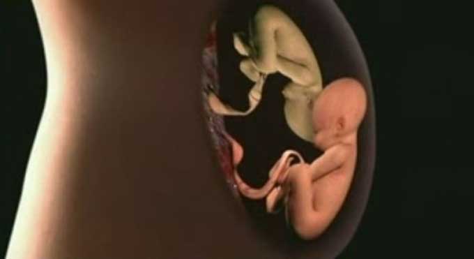 кто делал редукцию эмбриона