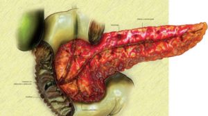 панкреонекроз поджелудочной железы