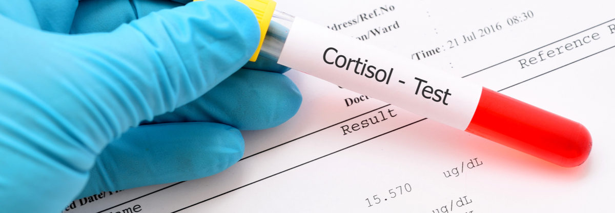 Как измеряют уровень кортизола