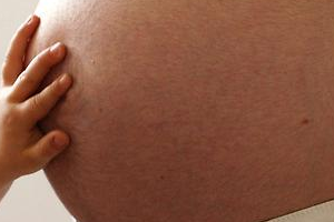 молочница в период беременности