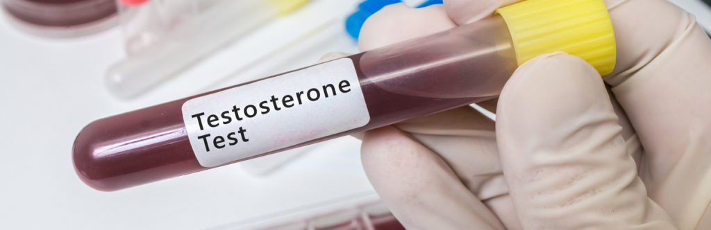 Анализы на тестостерон
