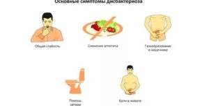 Основные симптомы дисбактериоза