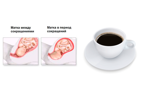 Возможный тонус матки в следствии употребления кофе беременной