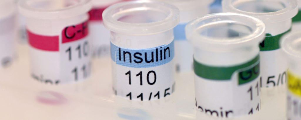 варианты проведения анализа на инсулин