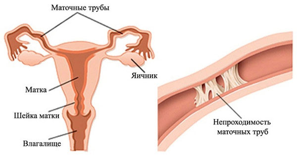 фаллопиевы или маточные трубы