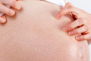 чешется тело во время беременности