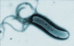 Бактерия хеликобактер пилори под микроскопом