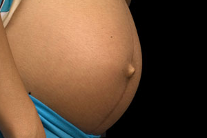 трещины в заднем проходе во время беременности
