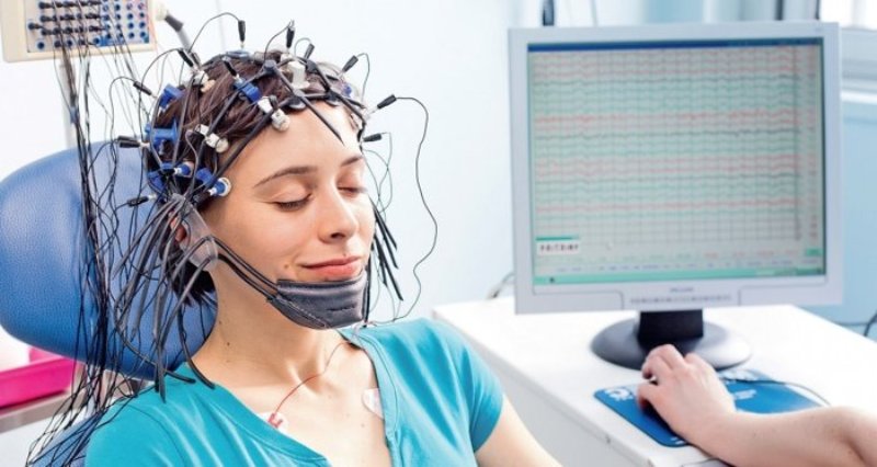 Электроэнцефалограмма головного мозга – что показывает, расшифровка ЭЭГ