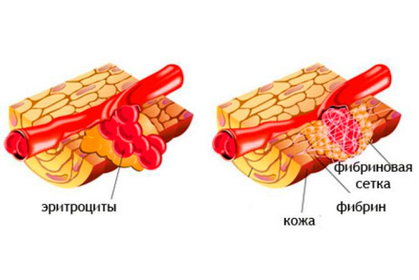 Процесс регенерации под действием фибриногена