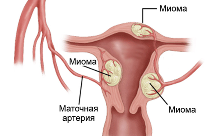 эндометрия матки норма при менопаузе