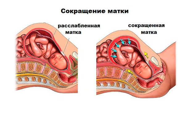 Возможный гипертонус матки из-за употребления клубники при беременности