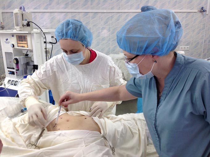 лапароскопия при внематочной беременности с сохранением трубы