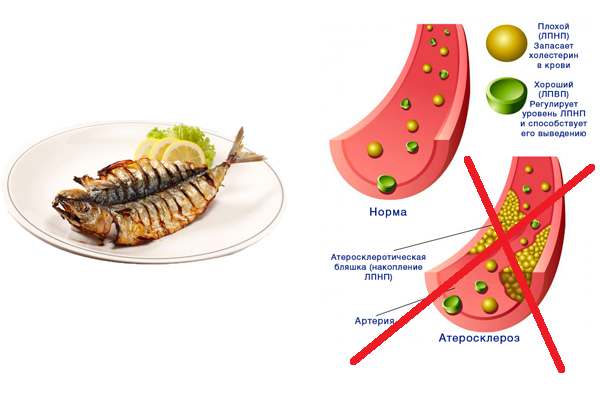 Предотвращение накоплению плохого холестерина при употреблении рыбы