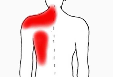Ноющая боль под левой и правой лопаткой сзади со спины: 20 причин, почему болит и что делать?
