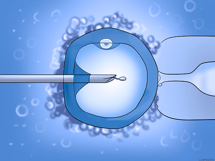 Внедрение сперматазоида в яйцеклетку для ее оплодотворения